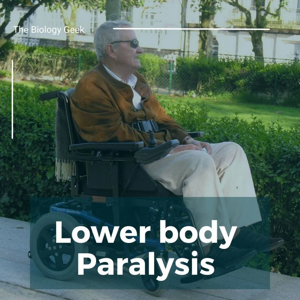 Paralysis symptoms 