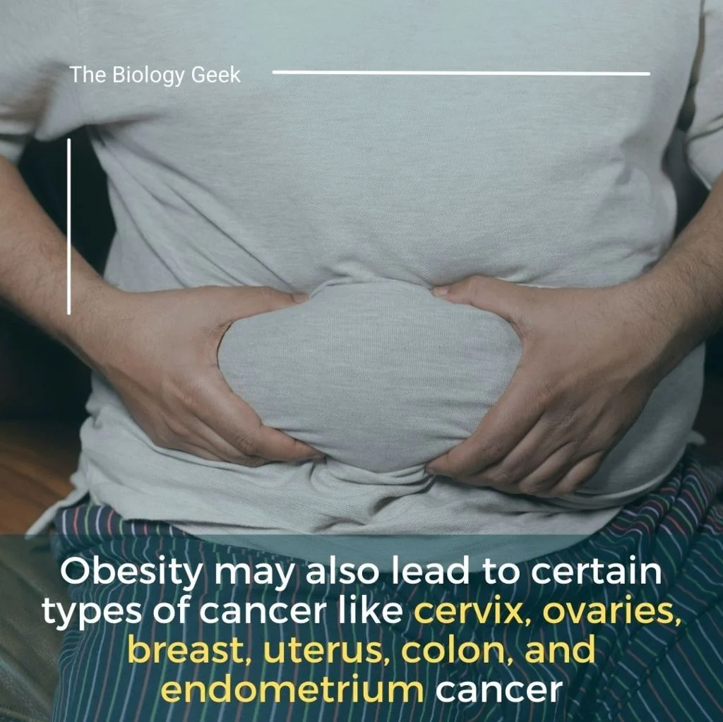 causes of overweight