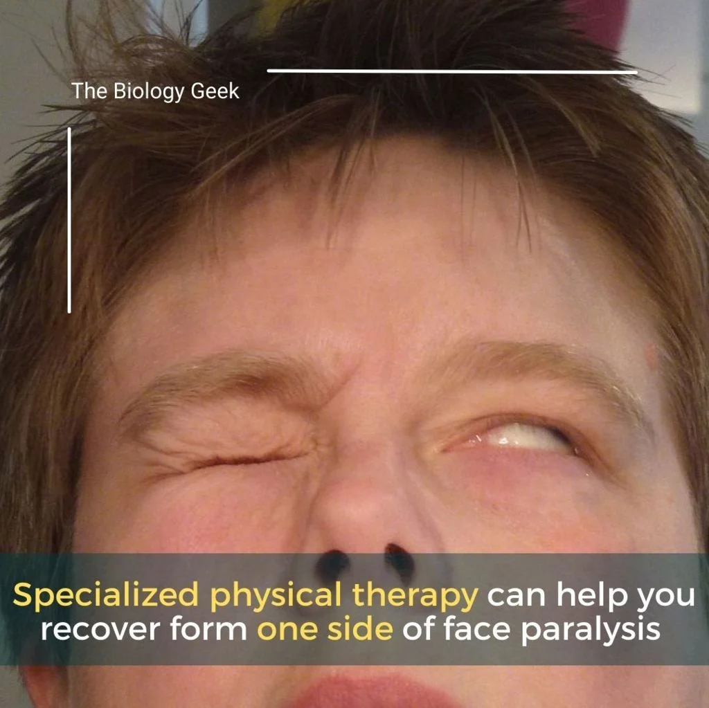 Face paralysis symptoms 
