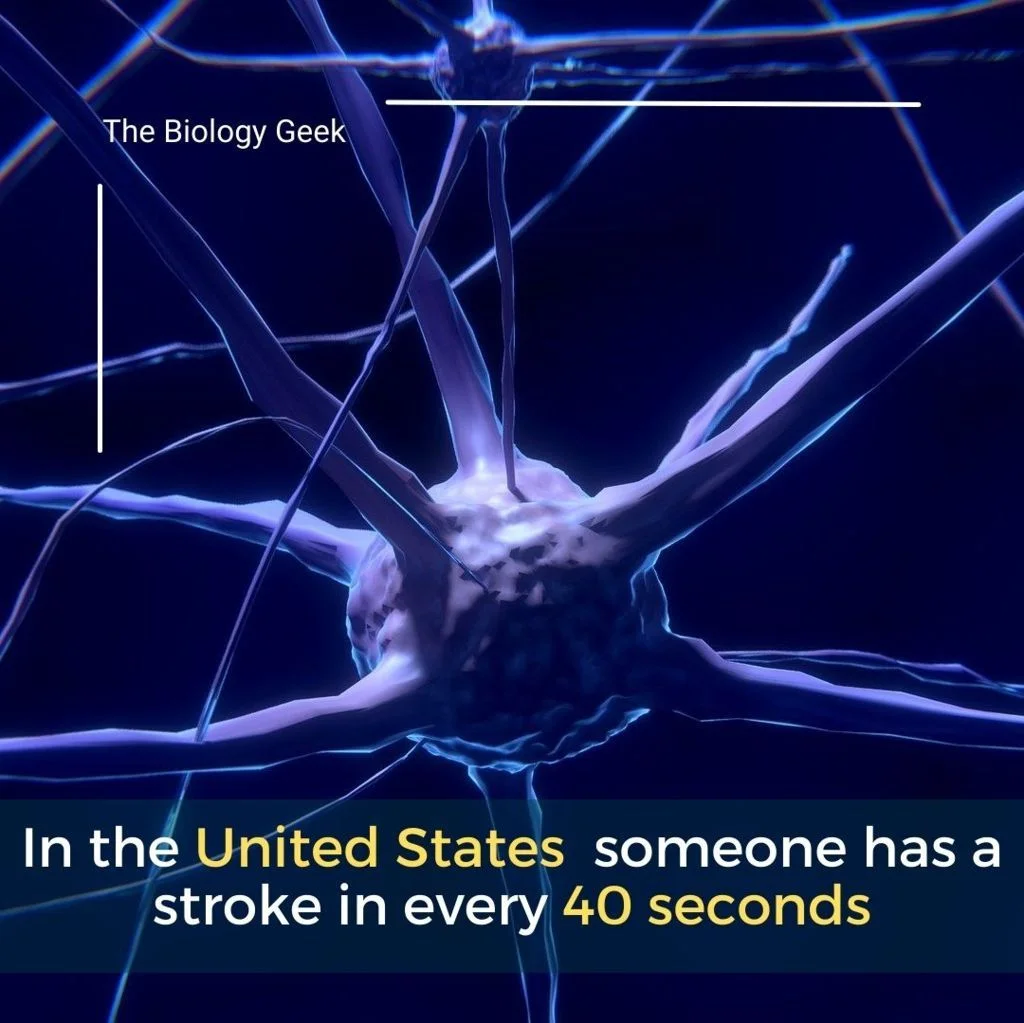 How do doctor test for stroke 
