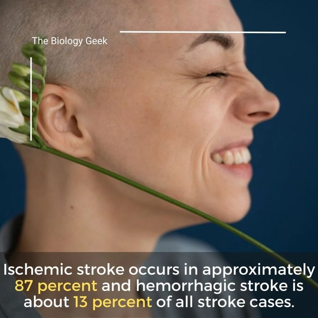 Hemorrhagic stroke vs Ischemic 